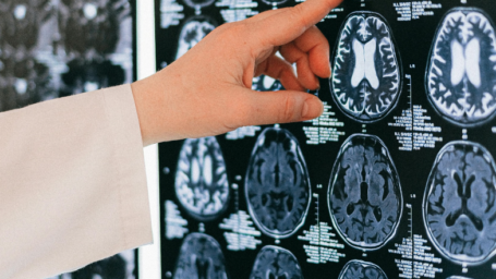 person's hand pointing at a brain scan