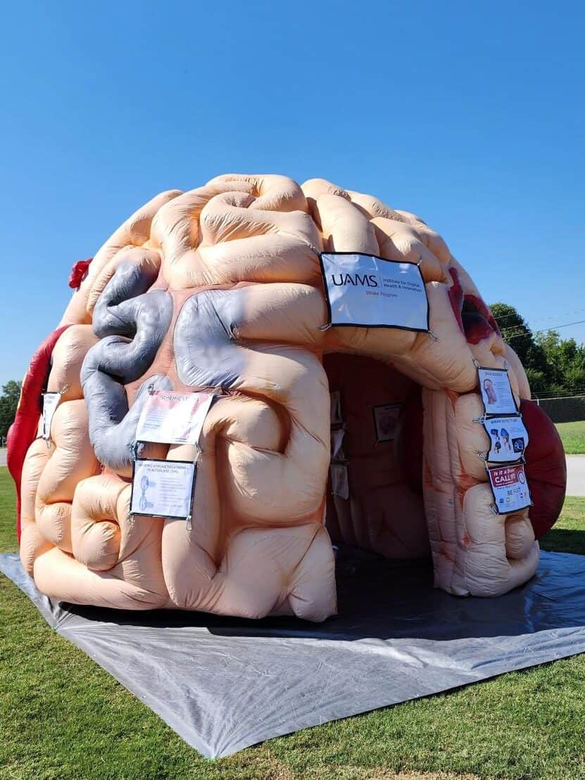 Inflatable brain